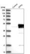 DNA fragmentation factor subunit alpha antibody, NBP1-85248, Novus Biologicals, Western Blot image 