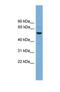 Ankyrin Repeat, SAM And Basic Leucine Zipper Domain Containing 1 antibody, NBP1-57071, Novus Biologicals, Western Blot image 