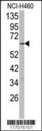 Cytochrome P450 Family 2 Subfamily R Member 1 antibody, 63-273, ProSci, Western Blot image 