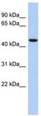 Zinc Finger Protein 566 antibody, TA341423, Origene, Western Blot image 