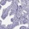 Calcium Binding Protein, Spermatid Associated 1 antibody, HPA055352, Atlas Antibodies, Immunohistochemistry frozen image 