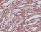 Mitogen-Activated Protein Kinase Kinase 1 antibody, M00292-1, Boster Biological Technology, Immunohistochemistry paraffin image 