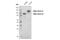 ALK Receptor Tyrosine Kinase antibody, 31278S, Cell Signaling Technology, Western Blot image 