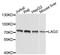 Lymphocyte Activating 3 antibody, A2996, ABclonal Technology, Western Blot image 