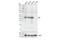 Protein Tyrosine Kinase 6 antibody, 55174S, Cell Signaling Technology, Western Blot image 