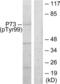 Tumor Protein P73 antibody, LS-C117453, Lifespan Biosciences, Western Blot image 
