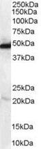 N-Myc Downstream Regulated 1 antibody, PA5-18109, Invitrogen Antibodies, Western Blot image 