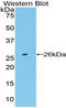 Proteasome Subunit Beta 8 antibody, LS-C295096, Lifespan Biosciences, Western Blot image 