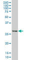 Regulator Of Calcineurin 1 antibody, LS-C197083, Lifespan Biosciences, Western Blot image 