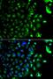 RAB5A, Member RAS Oncogene Family antibody, LS-B13360, Lifespan Biosciences, Immunofluorescence image 