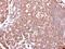 Mucin 4, Cell Surface Associated antibody, PA5-27267, Invitrogen Antibodies, Immunohistochemistry frozen image 