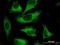 Calpastatin antibody, H00000831-M03, Novus Biologicals, Immunocytochemistry image 