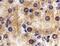 Interleukin 1 Receptor Like 1 antibody, PA5-20077, Invitrogen Antibodies, Immunohistochemistry paraffin image 