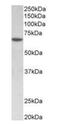 SRY-Box 11 antibody, orb125247, Biorbyt, Western Blot image 