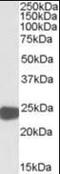 Peroxiredoxin 1 antibody, orb89322, Biorbyt, Western Blot image 