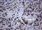 Nibrin antibody, LS-C175616, Lifespan Biosciences, Immunohistochemistry paraffin image 