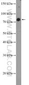 BUD13 Homolog antibody, 20163-1-AP, Proteintech Group, Western Blot image 