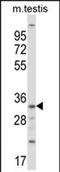 Ribosomal Protein S6 Kinase Related antibody, PA5-71887, Invitrogen Antibodies, Western Blot image 