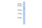 Translocase Of Inner Mitochondrial Membrane 44 antibody, A10278, Boster Biological Technology, Western Blot image 