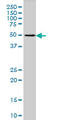 Melanin Concentrating Hormone Receptor 1 antibody, LS-C197336, Lifespan Biosciences, Western Blot image 