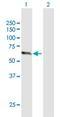 Zinc Finger Protein 18 antibody, H00007566-B01P, Novus Biologicals, Western Blot image 