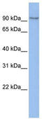 Transmembrane Protein 63B antibody, TA343879, Origene, Western Blot image 