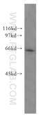 Mitochondrial Trans-2-Enoyl-CoA Reductase antibody, 51025-2-Ig, Proteintech Group, Western Blot image 