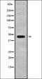 Proteasome 26S Subunit, Non-ATPase 13 antibody, orb337889, Biorbyt, Western Blot image 