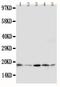 Growth Arrest And DNA Damage Inducible Alpha antibody, PA1402, Boster Biological Technology, Western Blot image 
