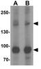 Vacuolar protein sorting-associated protein 13B antibody, GTX32078, GeneTex, Western Blot image 