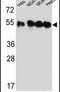 Tubulin Beta 4B Class IVb antibody, PA5-25050, Invitrogen Antibodies, Western Blot image 