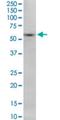 Sorting Nexin 8 antibody, H00029886-M08, Novus Biologicals, Western Blot image 