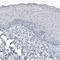 Angiotensin I Converting Enzyme 2 antibody, NBP2-59036, Novus Biologicals, Immunohistochemistry frozen image 