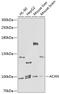 Aggrecan antibody, 23-644, ProSci, Western Blot image 