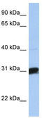 Beta-1,3-Galactosyltransferase 6 antibody, TA342089, Origene, Western Blot image 