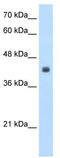 Kynurenine Aminotransferase 3 antibody, TA345720, Origene, Western Blot image 