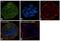 Hexokinase 1 antibody, MA5-15680, Invitrogen Antibodies, Immunofluorescence image 