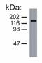 Neurofilament Medium antibody, LS-C45928, Lifespan Biosciences, Western Blot image 
