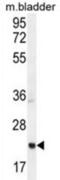 Achaete-Scute Family BHLH Transcription Factor 2 antibody, abx026018, Abbexa, Western Blot image 