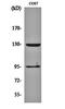 Gamma-Aminobutyric Acid Type B Receptor Subunit 1 antibody, orb161103, Biorbyt, Western Blot image 