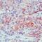 Mesothelin antibody, MA5-11918, Invitrogen Antibodies, Immunohistochemistry frozen image 