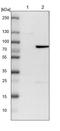 Zinc Finger And BTB Domain Containing 7B antibody, PA5-52351, Invitrogen Antibodies, Western Blot image 