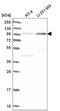 Adaptor Related Protein Complex 2 Subunit Alpha 2 antibody, NBP2-55531, Novus Biologicals, Western Blot image 