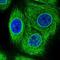Torsin 1A Interacting Protein 1 antibody, NBP2-47402, Novus Biologicals, Immunocytochemistry image 