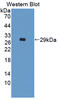 Interferon Alpha And Beta Receptor Subunit 2 antibody, LS-C373234, Lifespan Biosciences, Western Blot image 