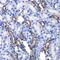Megakaryocyte-Associated Tyrosine Kinase antibody, GTX64561, GeneTex, Immunohistochemistry paraffin image 