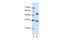 WD Repeat Domain 6 antibody, GTX47169, GeneTex, Western Blot image 