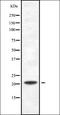 Programmed Cell Death 6 antibody, orb336956, Biorbyt, Western Blot image 