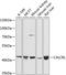 Calcitonin Receptor Like Receptor antibody, A04042, Boster Biological Technology, Western Blot image 