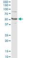 Glutamate Dehydrogenase 2 antibody, H00002747-M01, Novus Biologicals, Western Blot image 